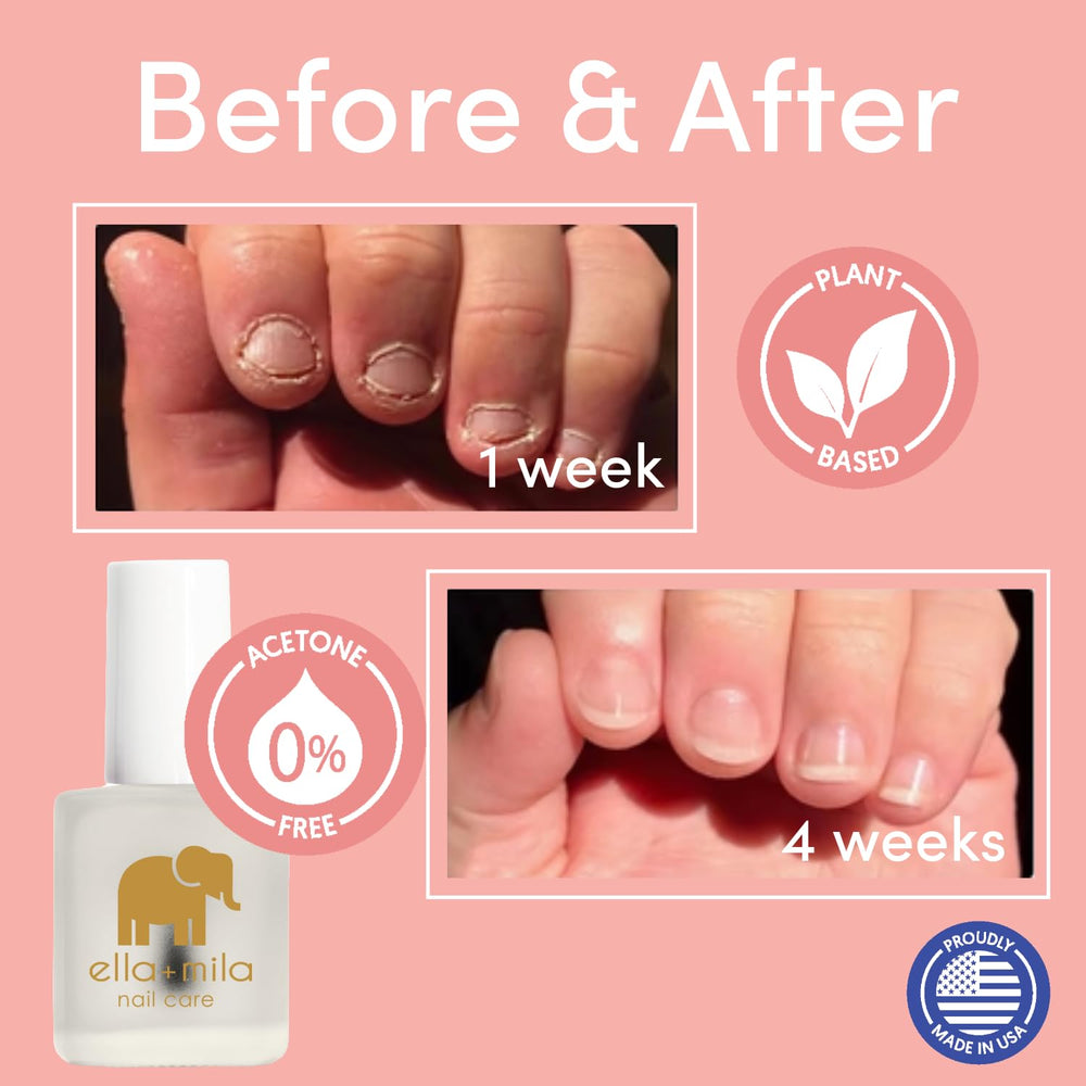 Child-friendly use with ella-mila No More Biting Nail Polish during routine.