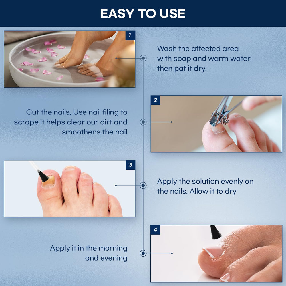 Closeup of discolored nail showing potential improvement with Ellocy treatment.