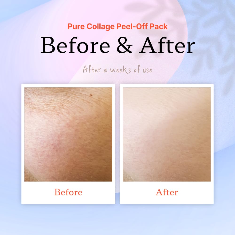ELT Peel Off action highlights clean removal with residue-free finish