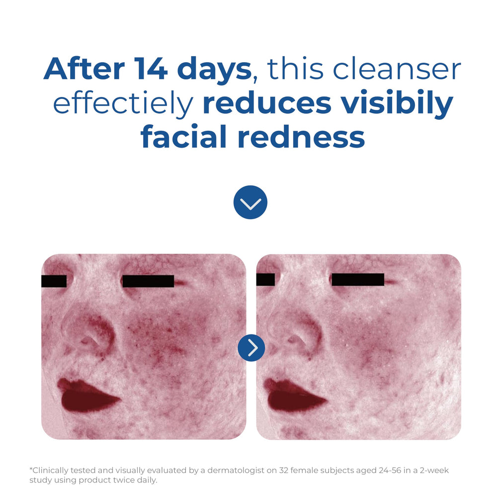 Suitable for all skin types with gentle cleansing