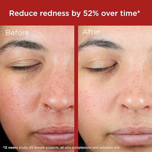 EltaMD UV Skin Recovery SPF 50 on hand illustrates easy daily application and absorption