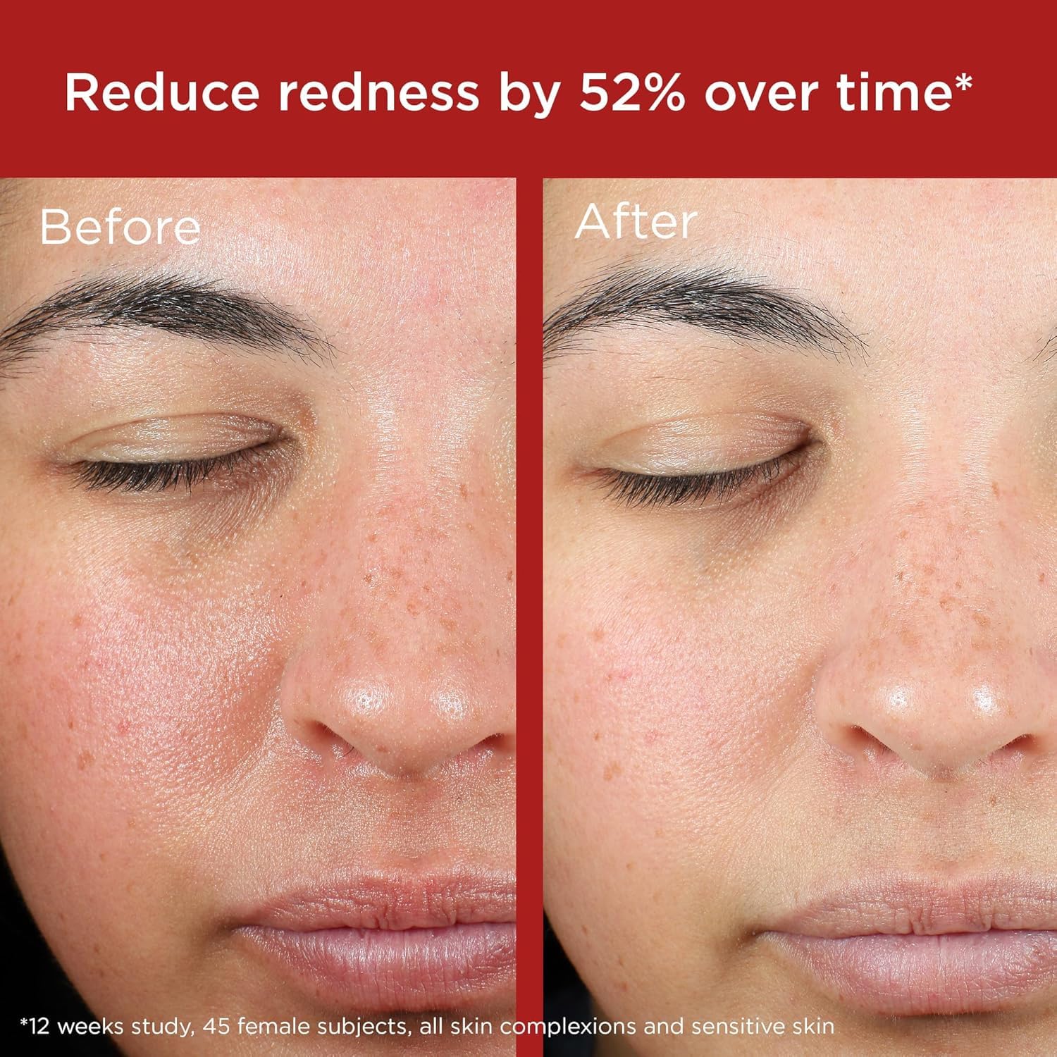 Green tint swatch on skin demonstrates color correction with EltaMD.