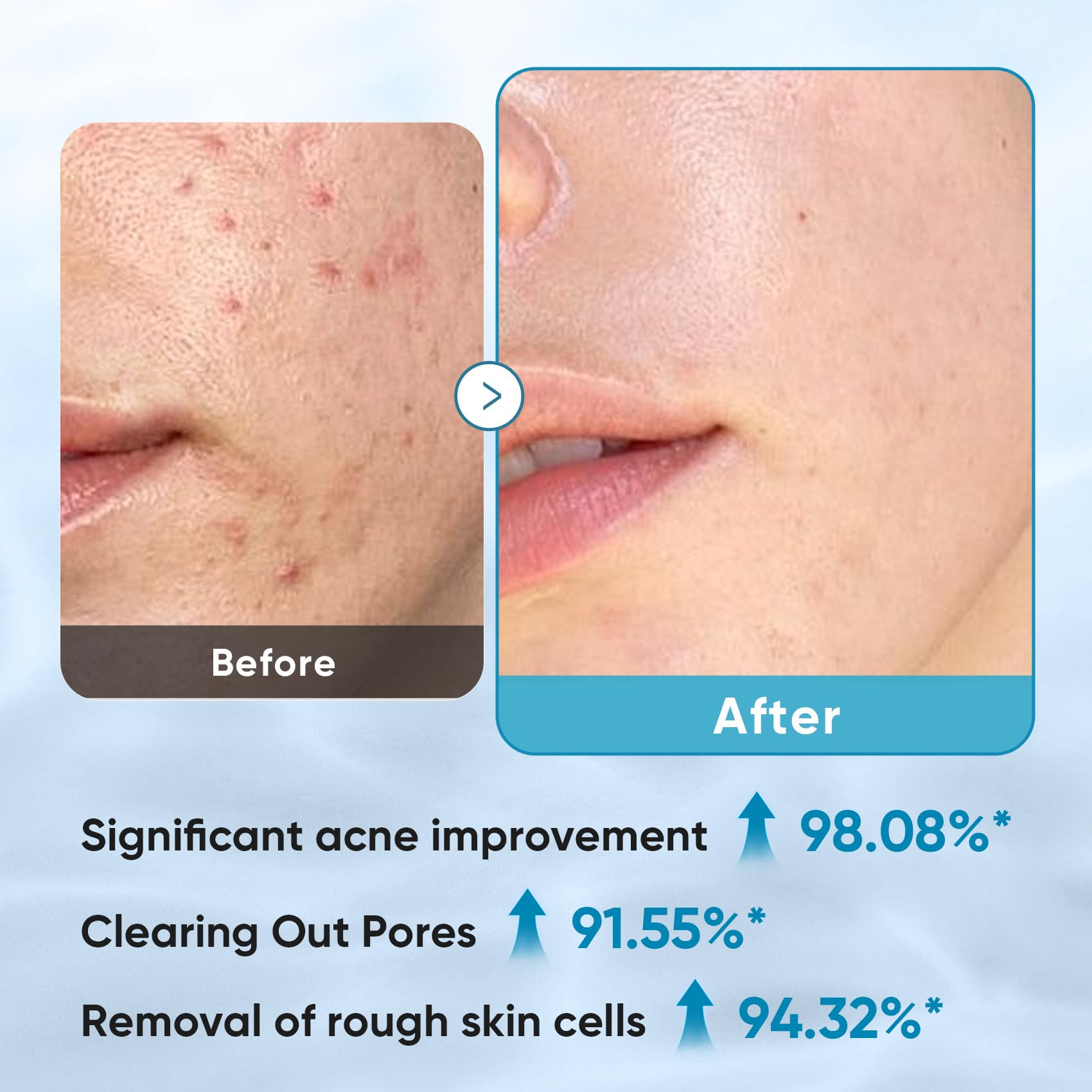 Elvira Glycolic Pads pad texture side close-up for exfoliation