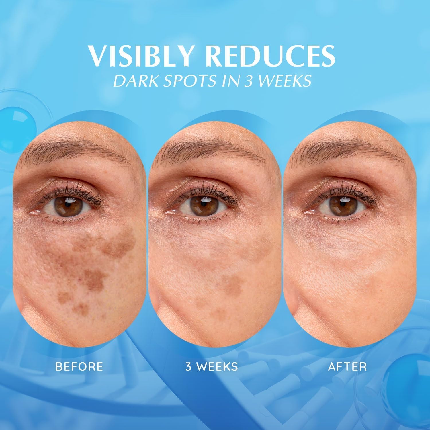 EnaSkin Dark Spot Serum on skin for daily use