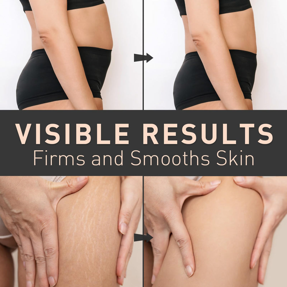 Enaskin Naturals Belly Firming Cream applied on skin for absorption