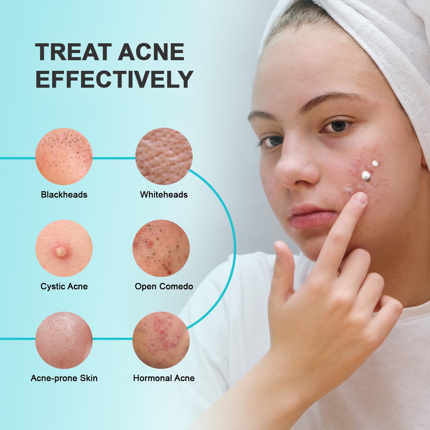 Enaskin Naturals face and back acne treatment provides clearer skin where you need it most