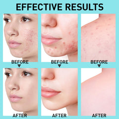 Enaskin Naturals cream texture close-up hints at gentle brightening and oil control.