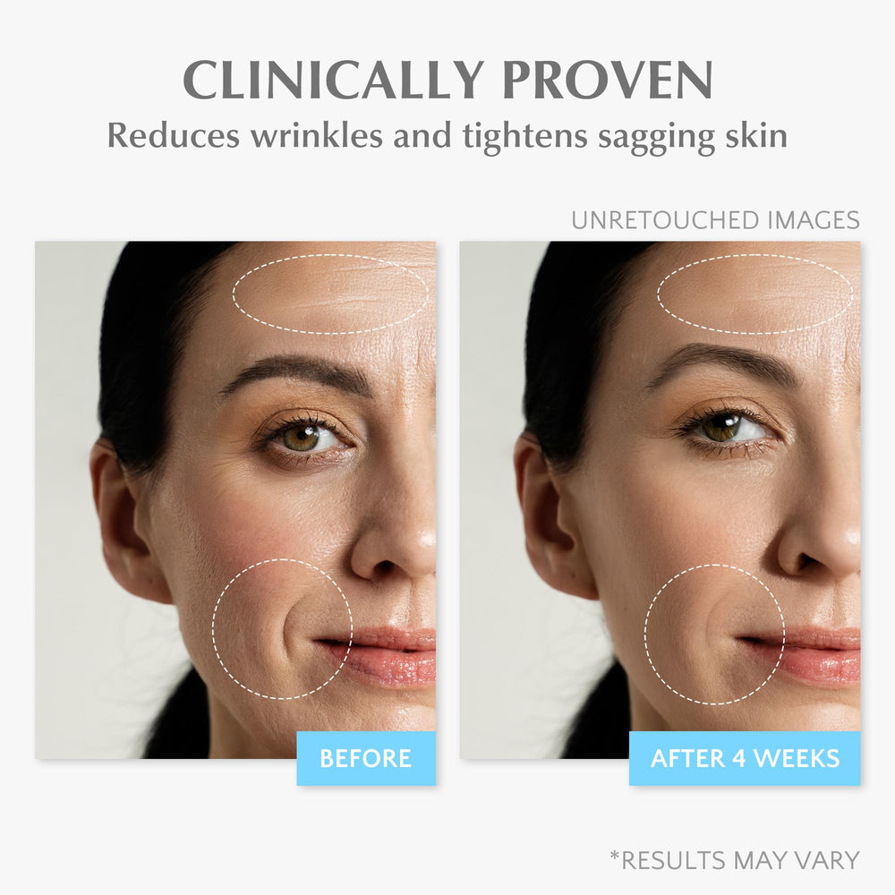 Visual of wrinkle smoothing and a subtle lift effect