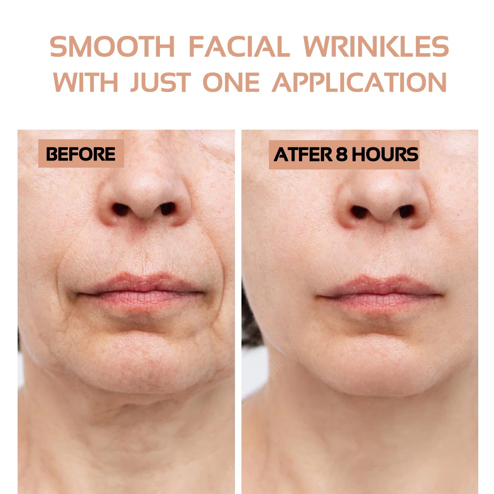 ENROSLU clear overnight patches on skin for discreet wear.