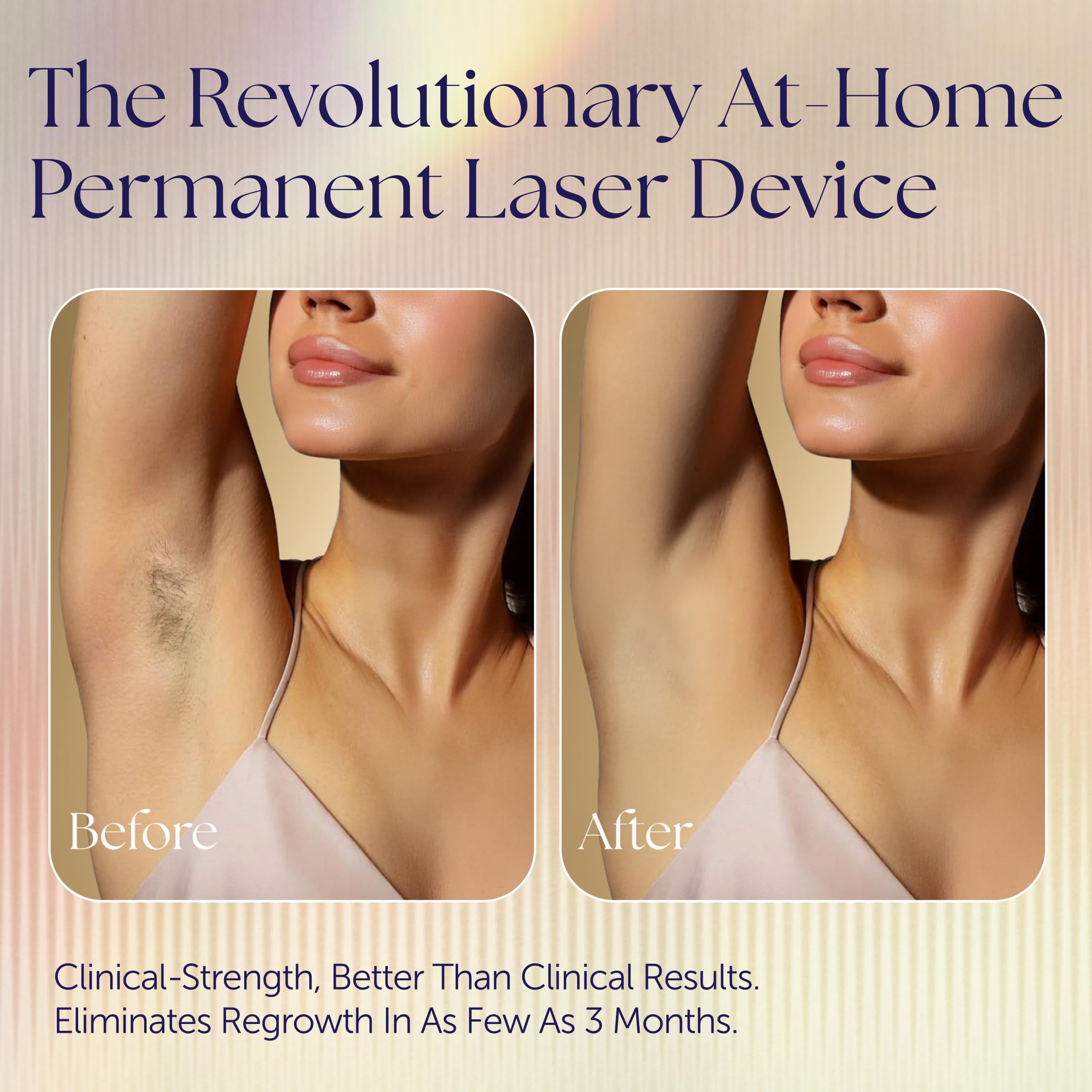 Epilady Epilaser safe skin-targeting technology preserves surrounding skin.