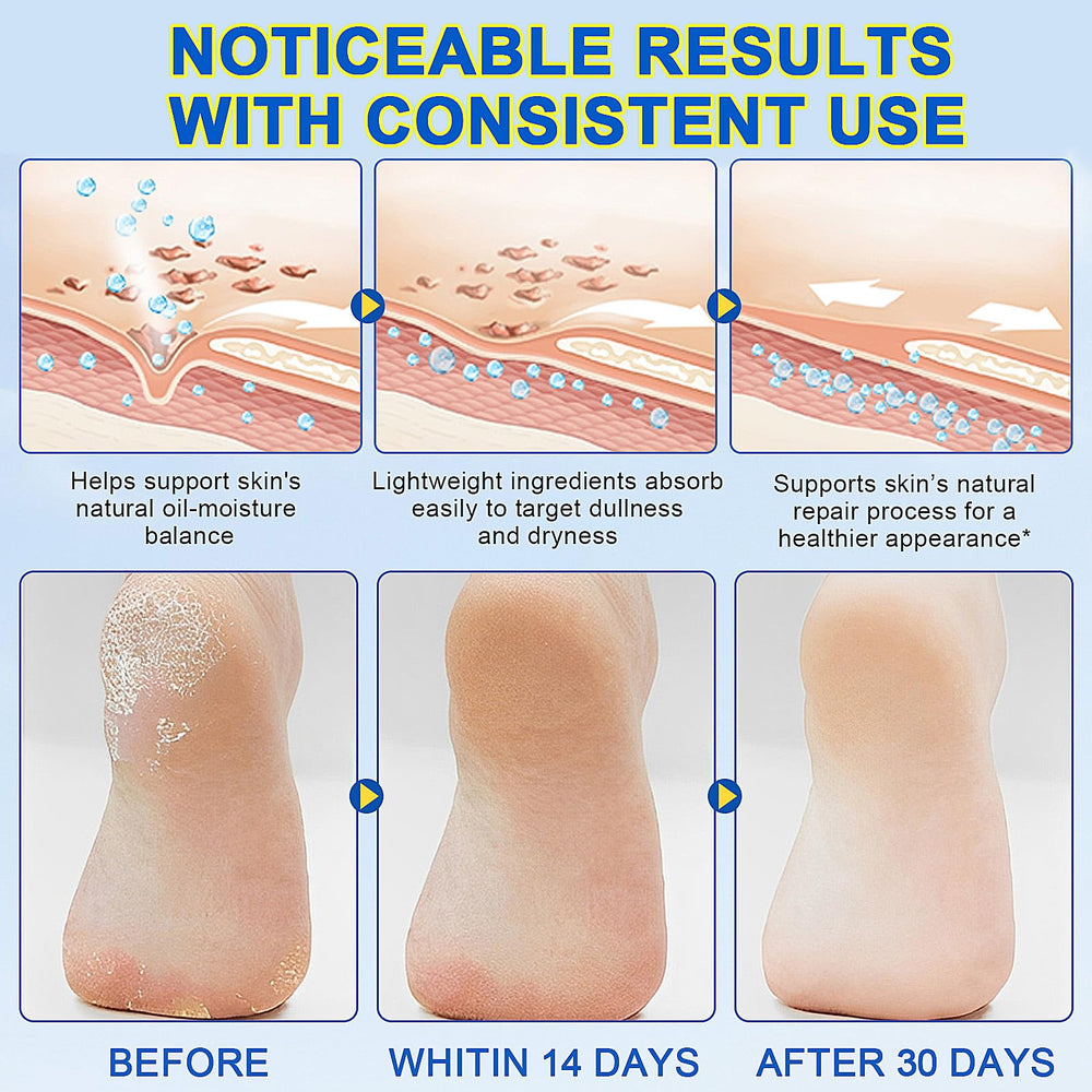 Eqimznv Urea Cream Stick portable size supports on-the-go hydration all day.