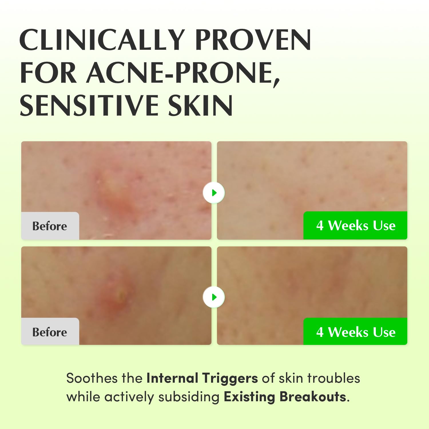 EQQUALBERRY Aloe PDRN ingredient label highlights soothing regeneration signals