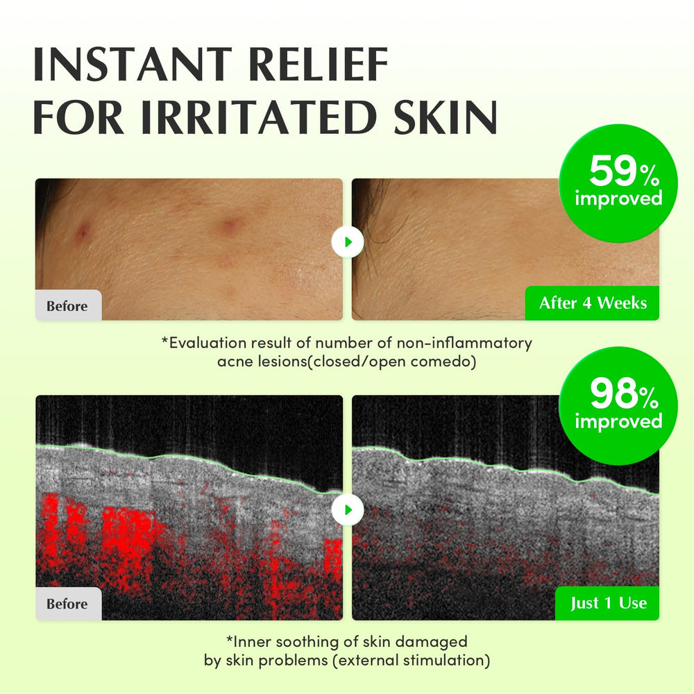 EQQUALBERRY Jeju green tea extract on skin demonstrates sebum control potential