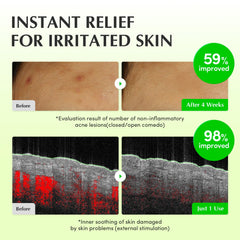 EQQUALBERRY Jeju green tea extract on skin demonstrates sebum control potential
