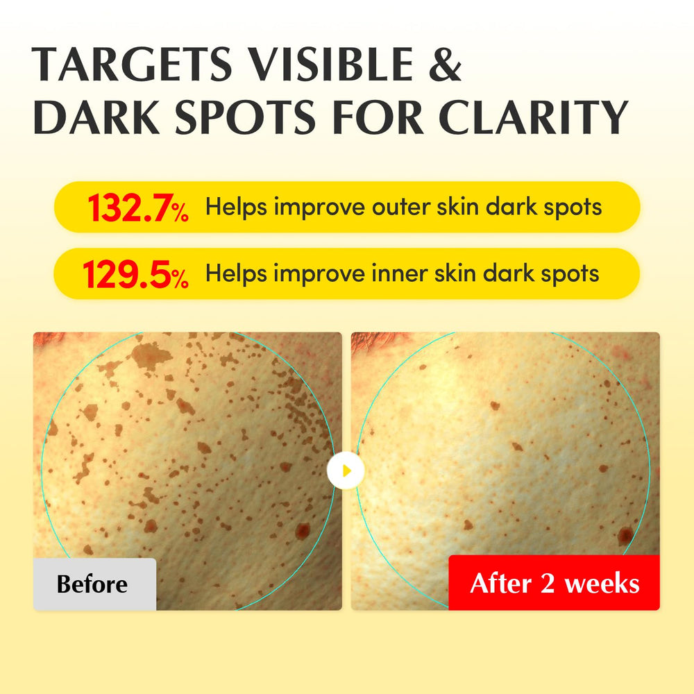 Application gesture with EQQUALBERRY cream for quick absorption and glow.