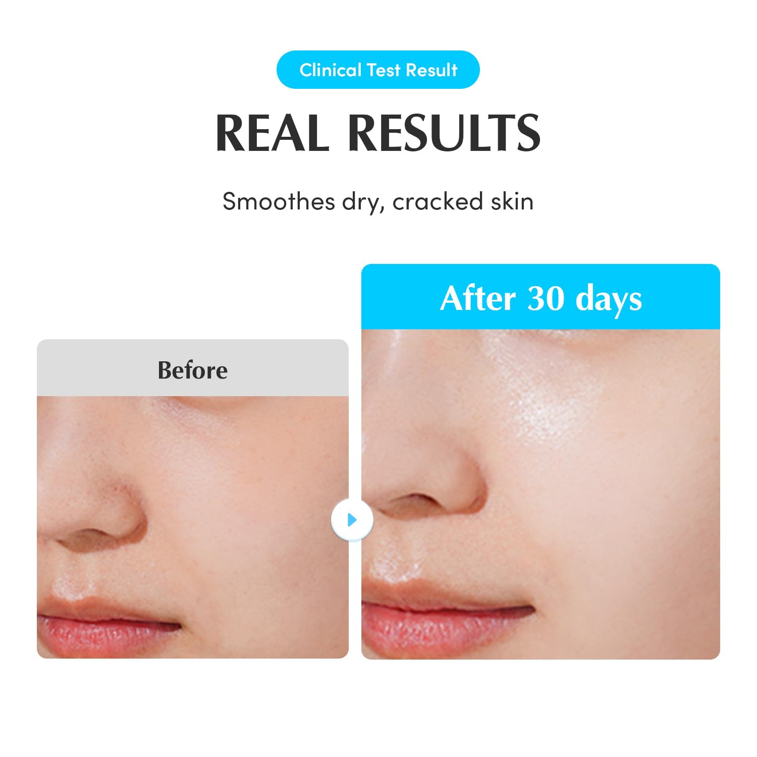 EQQUALBERRY Lightweight, non-sticky serum texture shown on skin