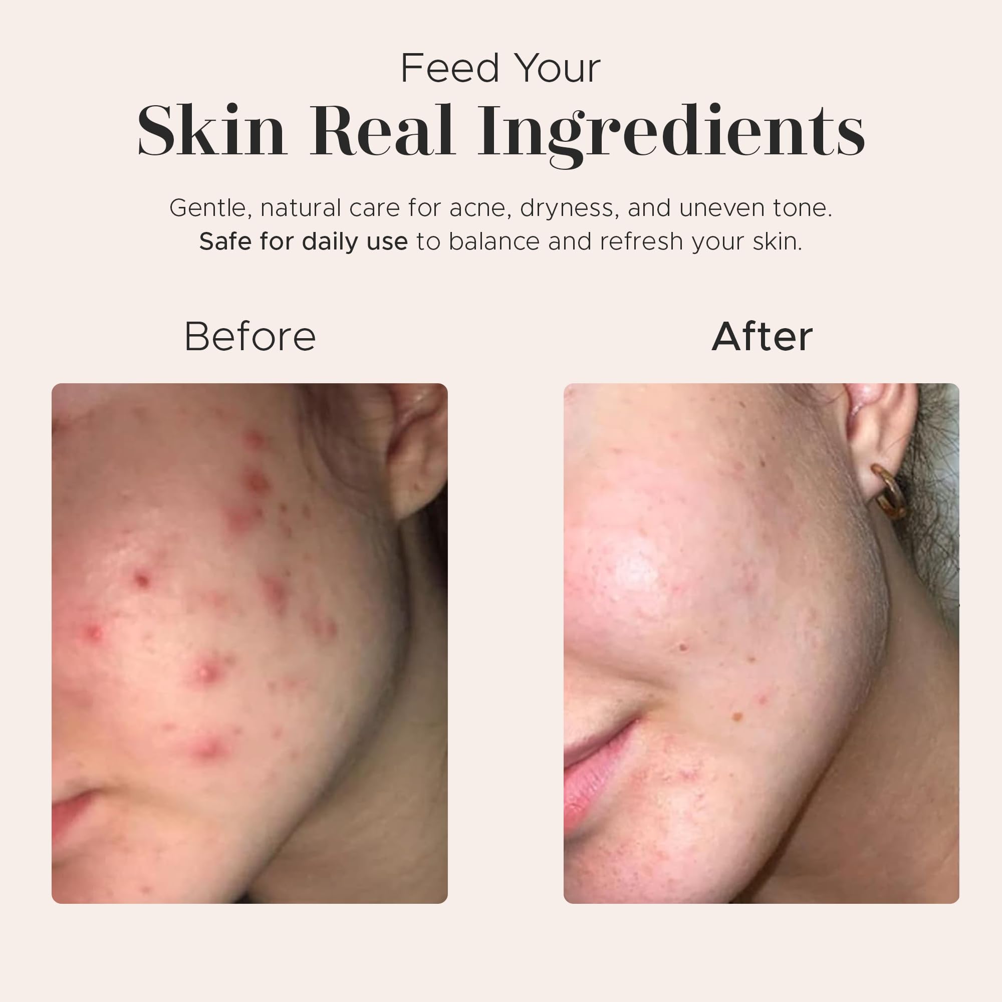 Era of nature facial cleansing application with gentle exfoliation.