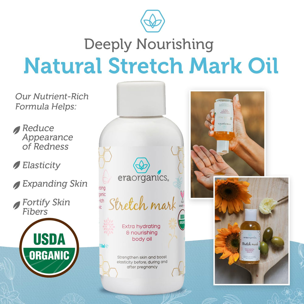 Era Organics stretch-mark oil dry-skin-relief soothes and nourishes dry areas.