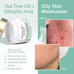 Era Organics Tea Tree Cream application close-up on the skin