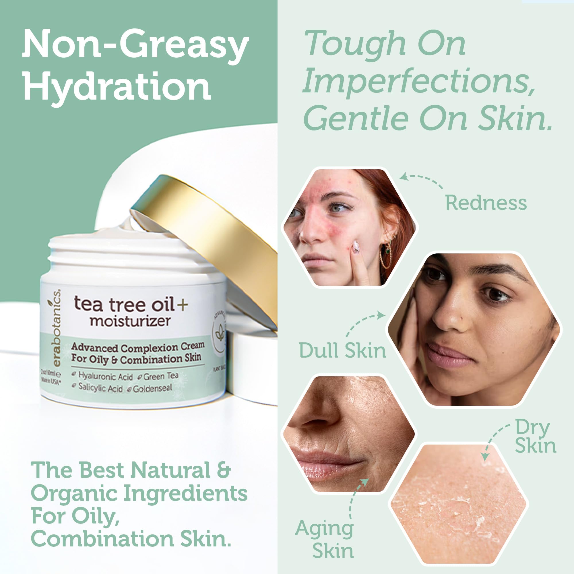 Era Organics Tea Tree Cream packaging highlighting cruelty-free branding