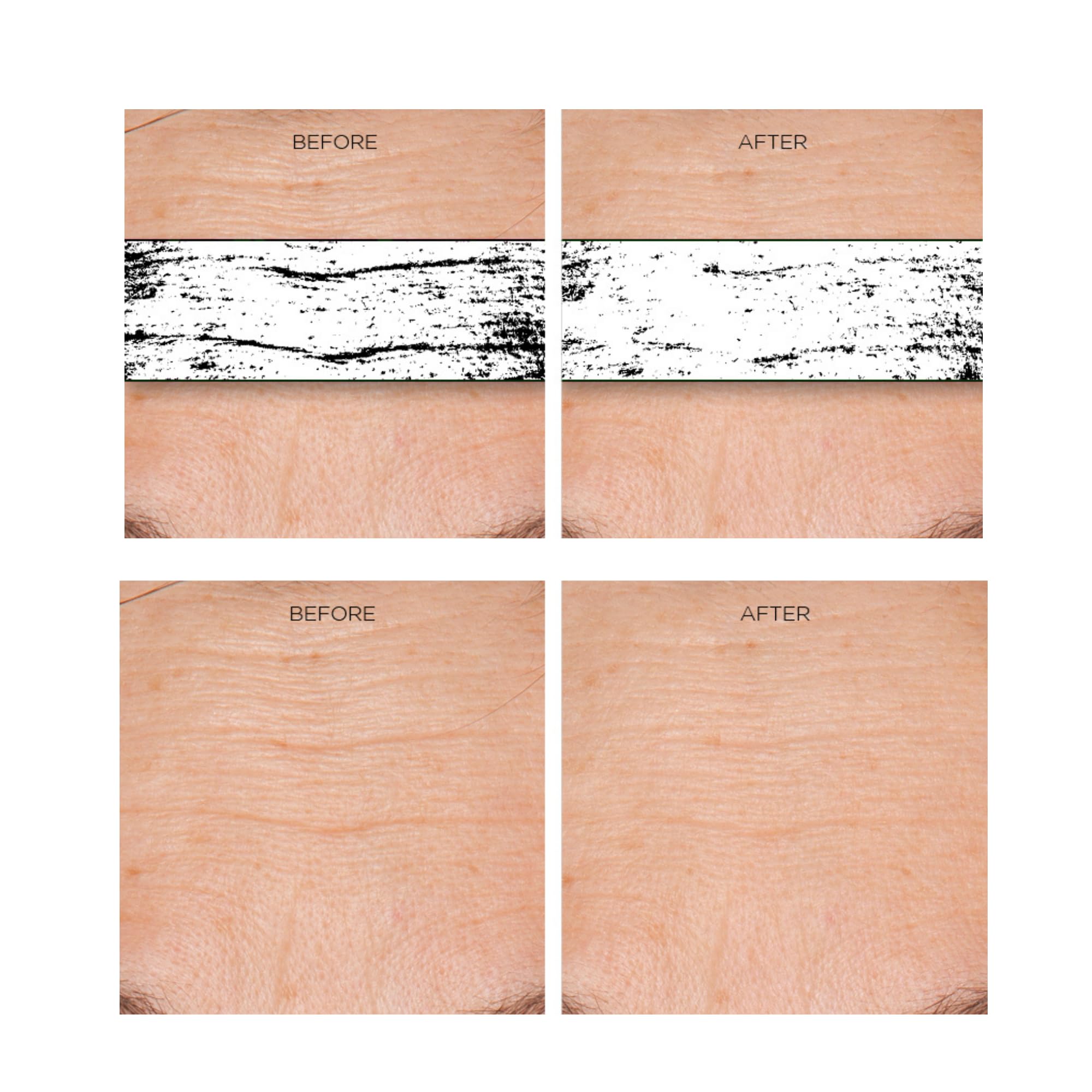 After-use skin glow and smoothness with Erasa XEP 30
