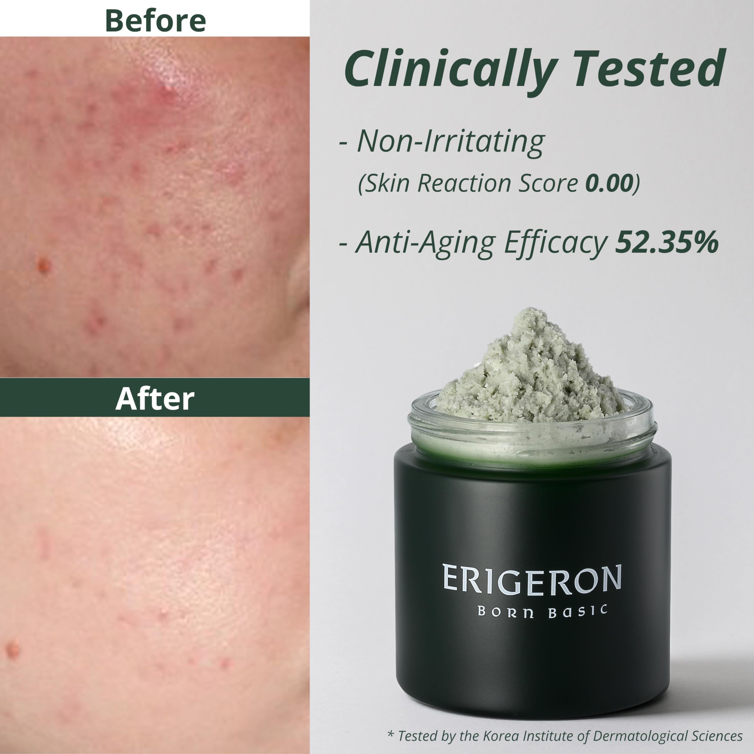 ERIGERON Heartleaf Cleanser foam-texture shows creamy daily cleansing.