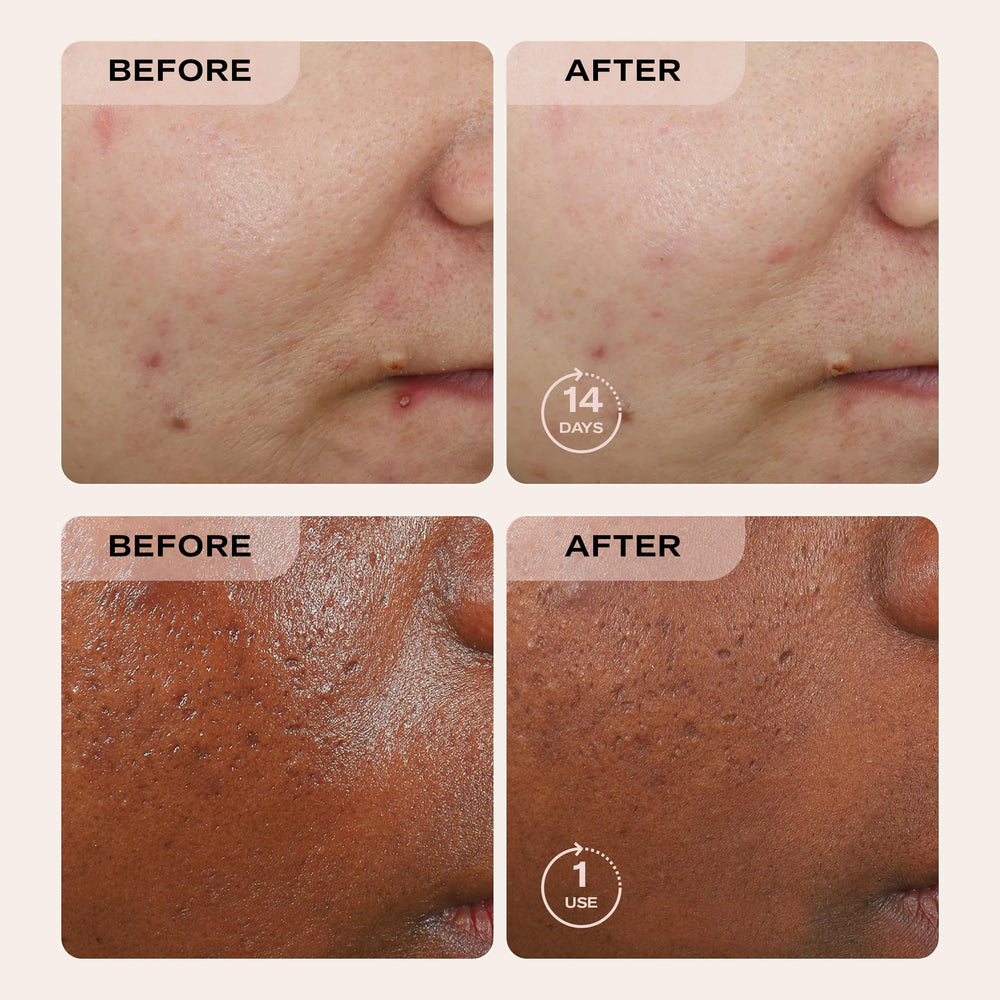 Deep-clean action of charcoal in Erno Laszlo Sea Mud Bar around pores