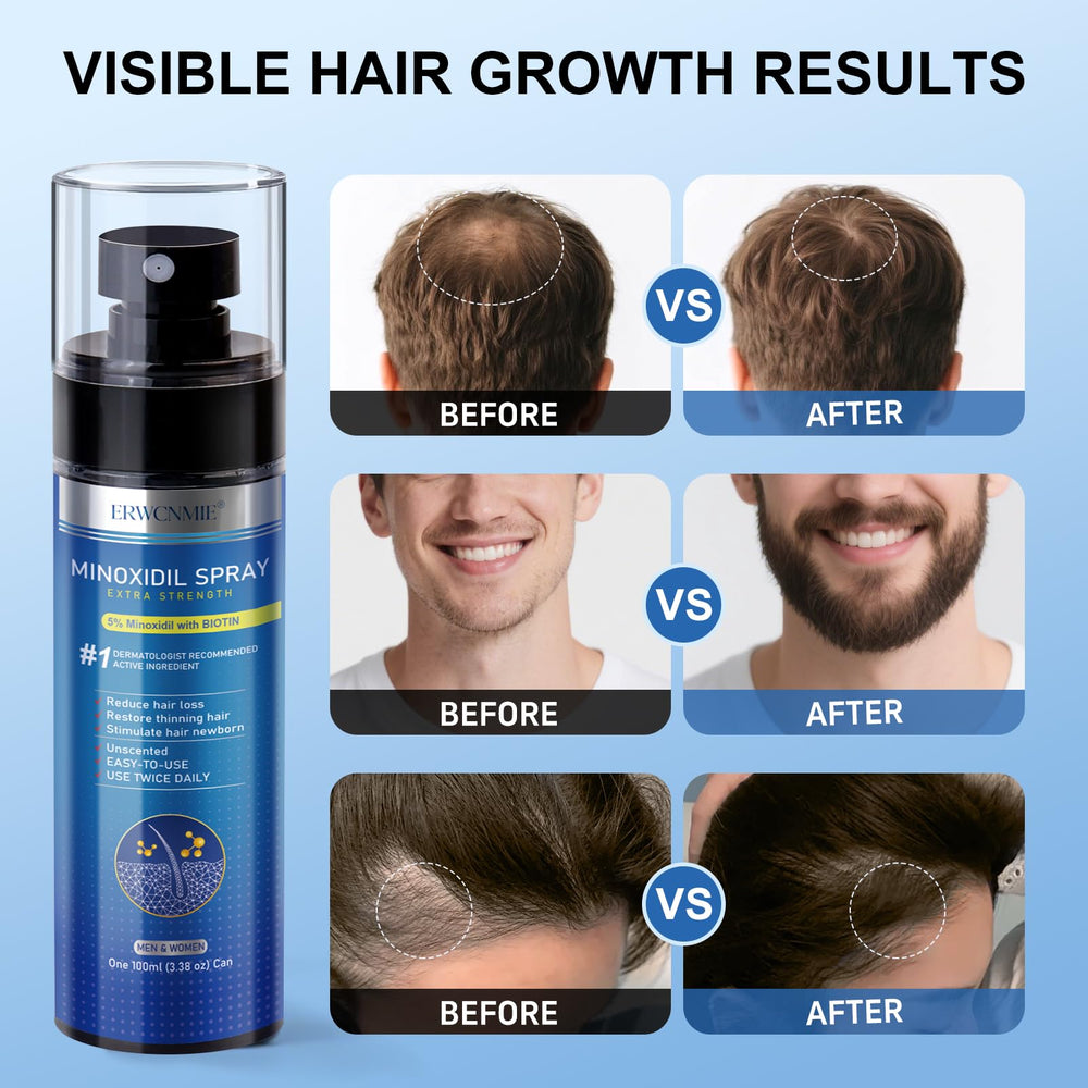 ERWCNMIE beard growth application targets thinning beard areas.