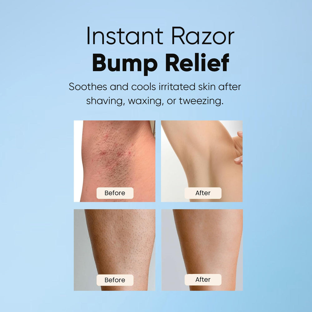 ESTETIST Razor Bump Roll-On being applied to leg for irritation relief.
