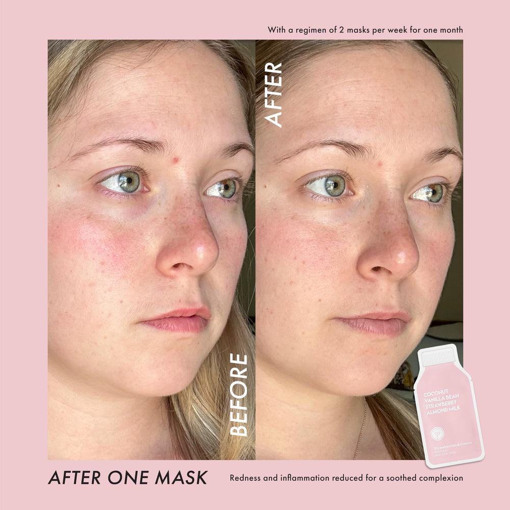 Applying ESW Beauty Strawberries and Cream mask on the face for cooling soothing feel