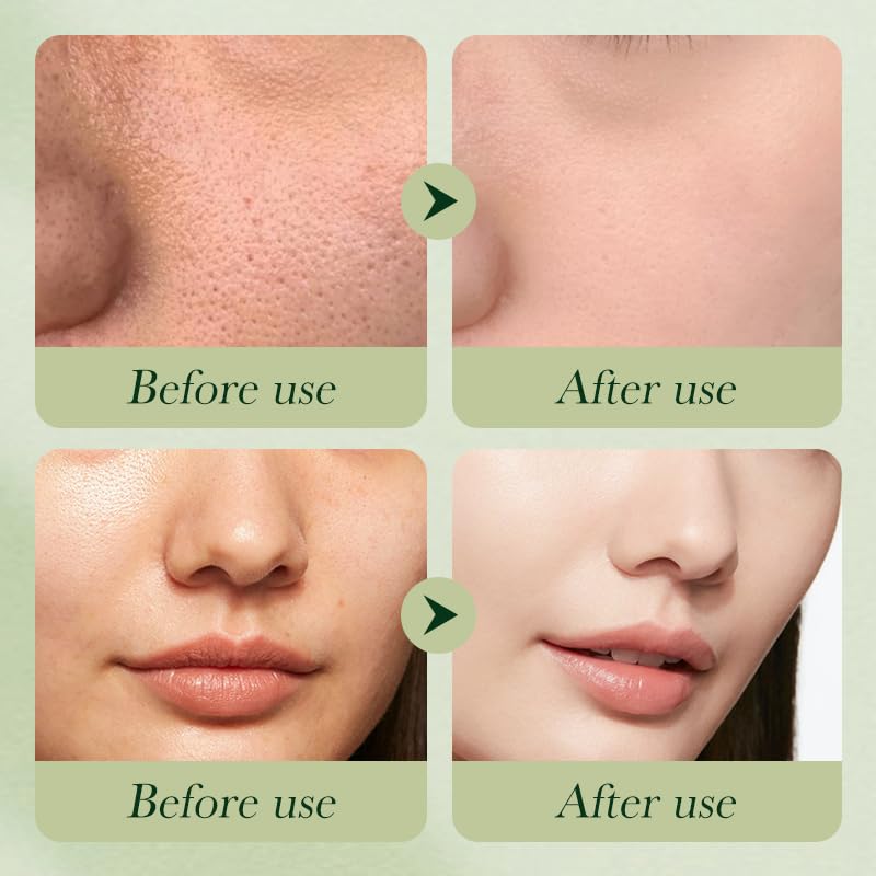 Etuanxi Avocado Moisturizing Lotion bottle offering light, fast-absorbing hydration.