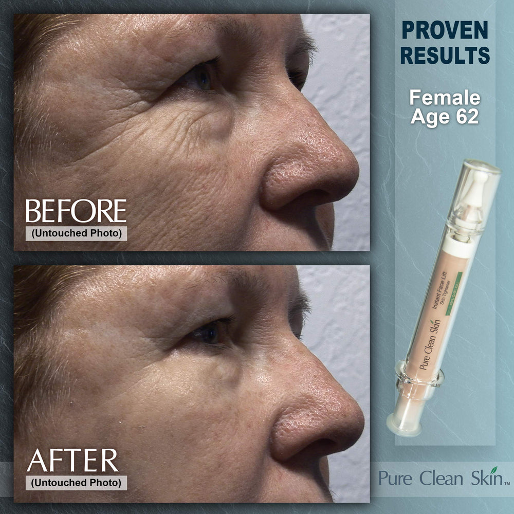 EUZEN Cream texture shows quick absorption with a non-greasy finish.