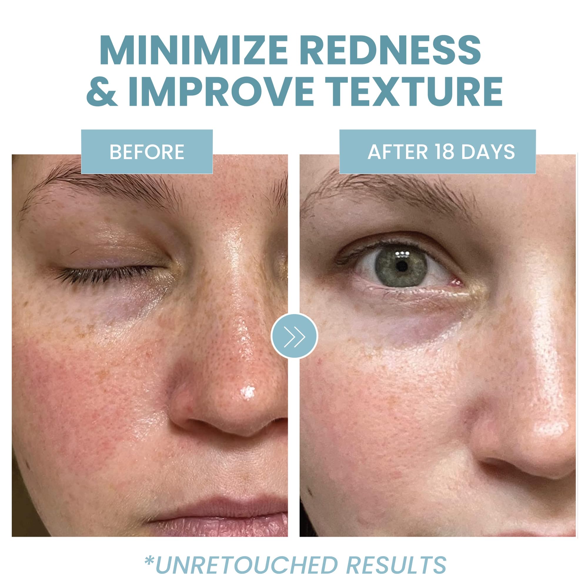 Eva Naturals fragrance-free label close-up for sensitive skin clarity