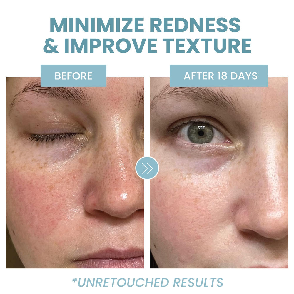 Eva Naturals fragrance-free label close-up for sensitive skin clarity