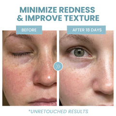 Eva Naturals fragrance-free label close-up for sensitive skin clarity