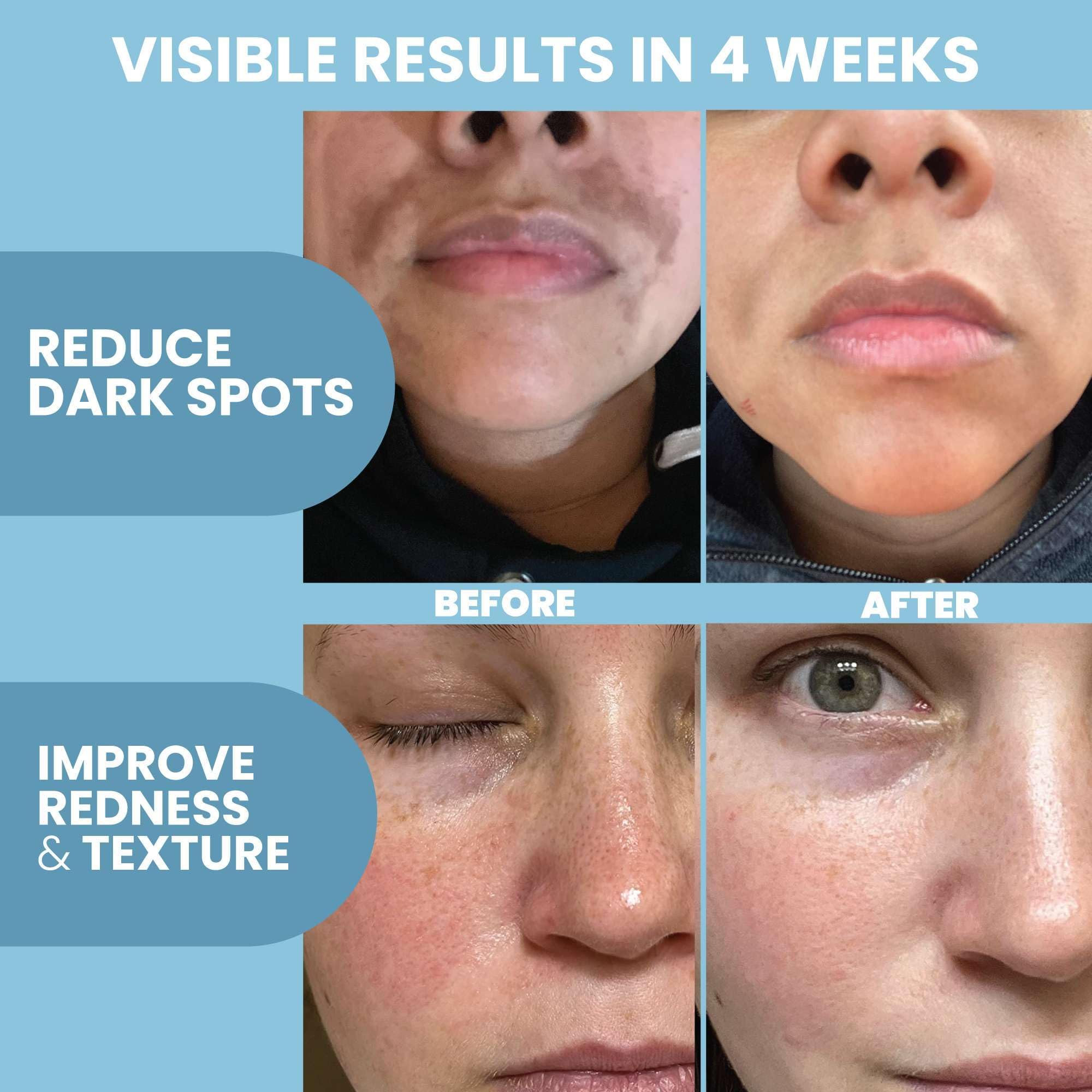Hyaluronic acid ingredient badge showing hydration focus for balanced skin.