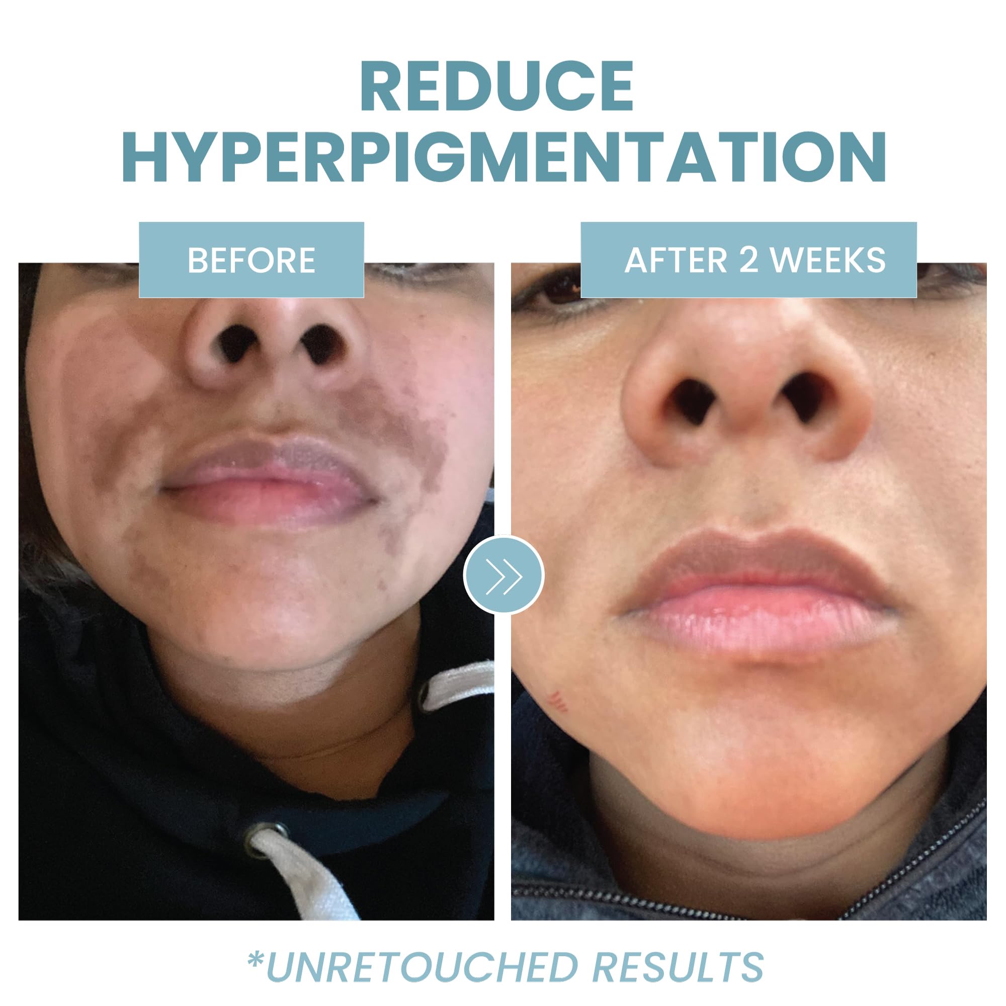 Eva Naturals serum application on hand demonstrating easy AM/PM use