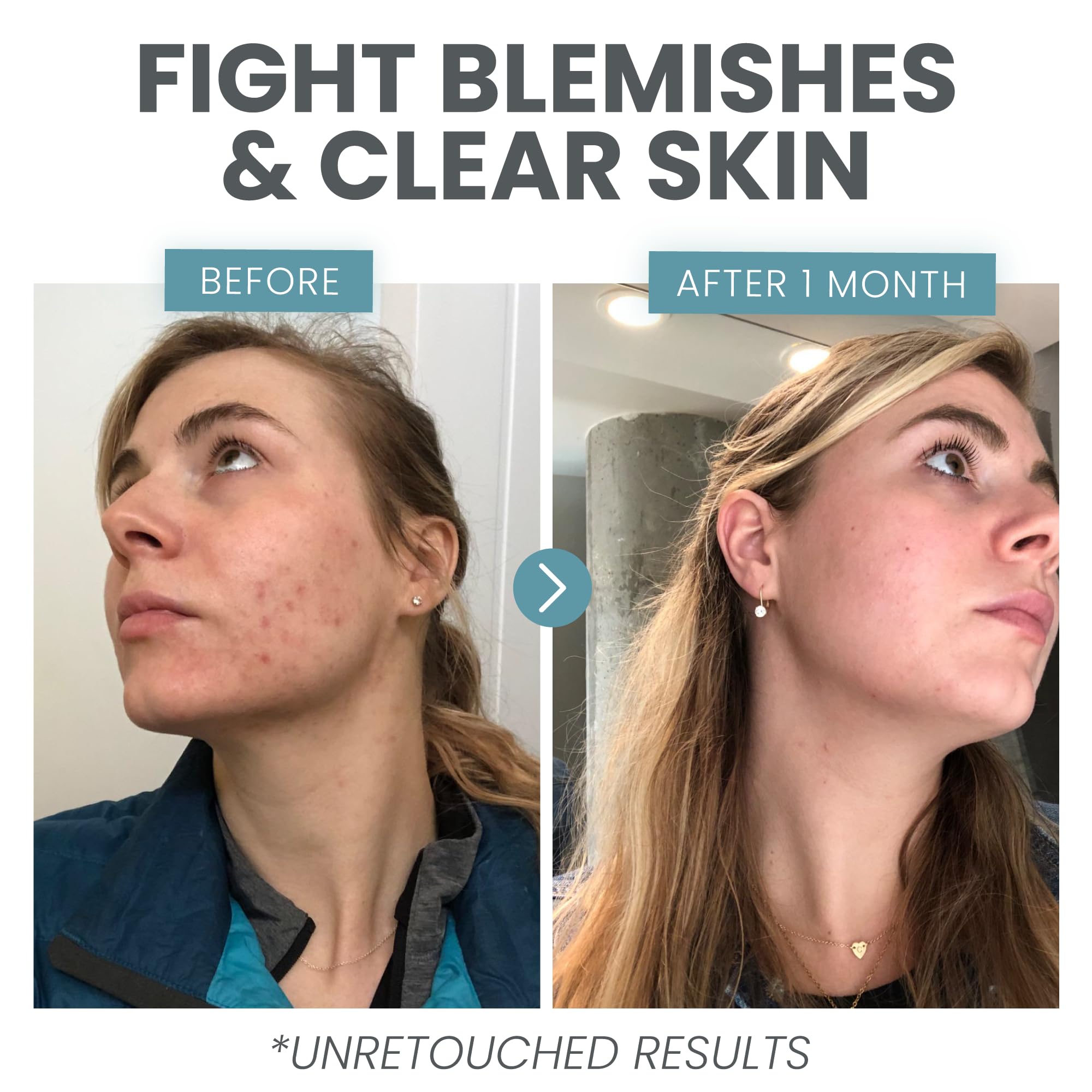 Close-up of applying Eva Naturals serum to the face for even tone.