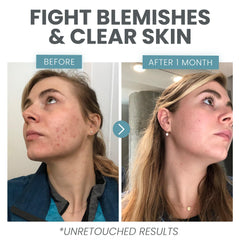Close-up of applying Eva Naturals serum to the face for even tone.