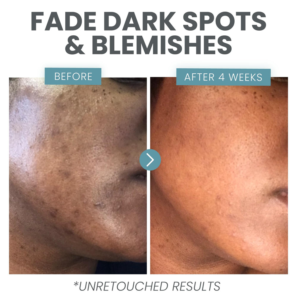 Morning routine with Eva Naturals serum promotes balanced skin.