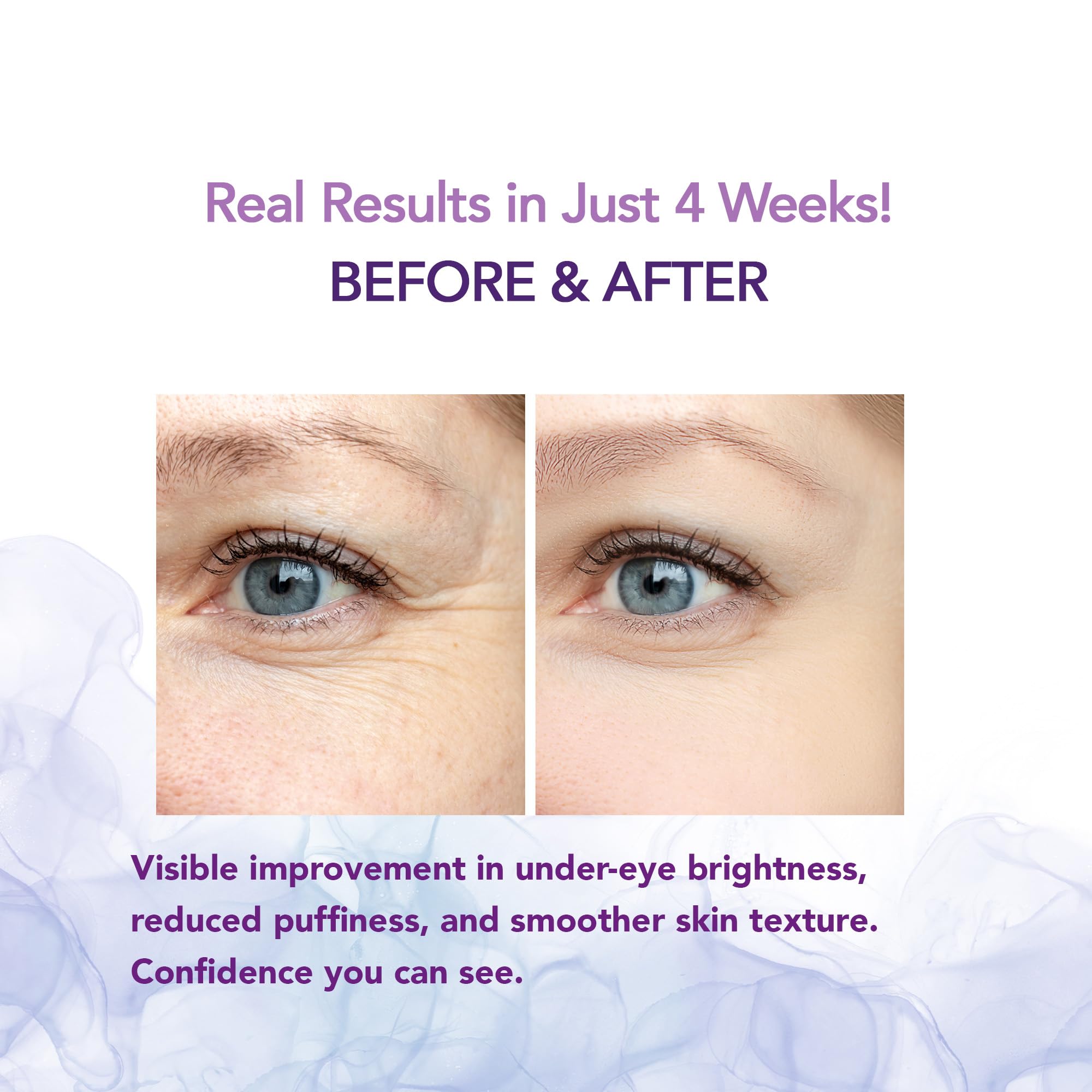 Evdayam Caffeine Eye Cream brightening under-eye area after use.