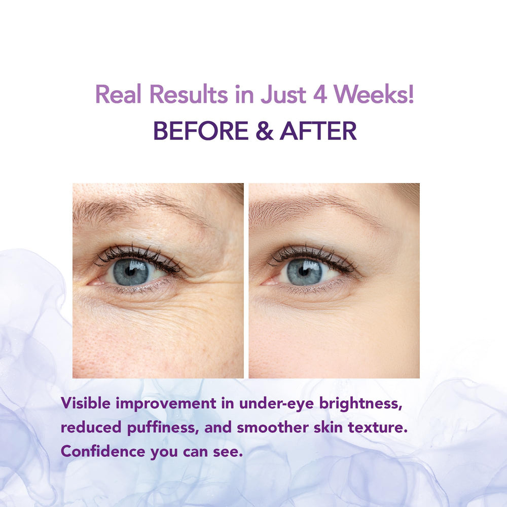 Evdayam Caffeine Eye Cream brightening under-eye area after use.