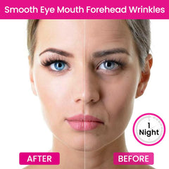 evpct 256pcs cheek patch helps smooth texture on cheeks