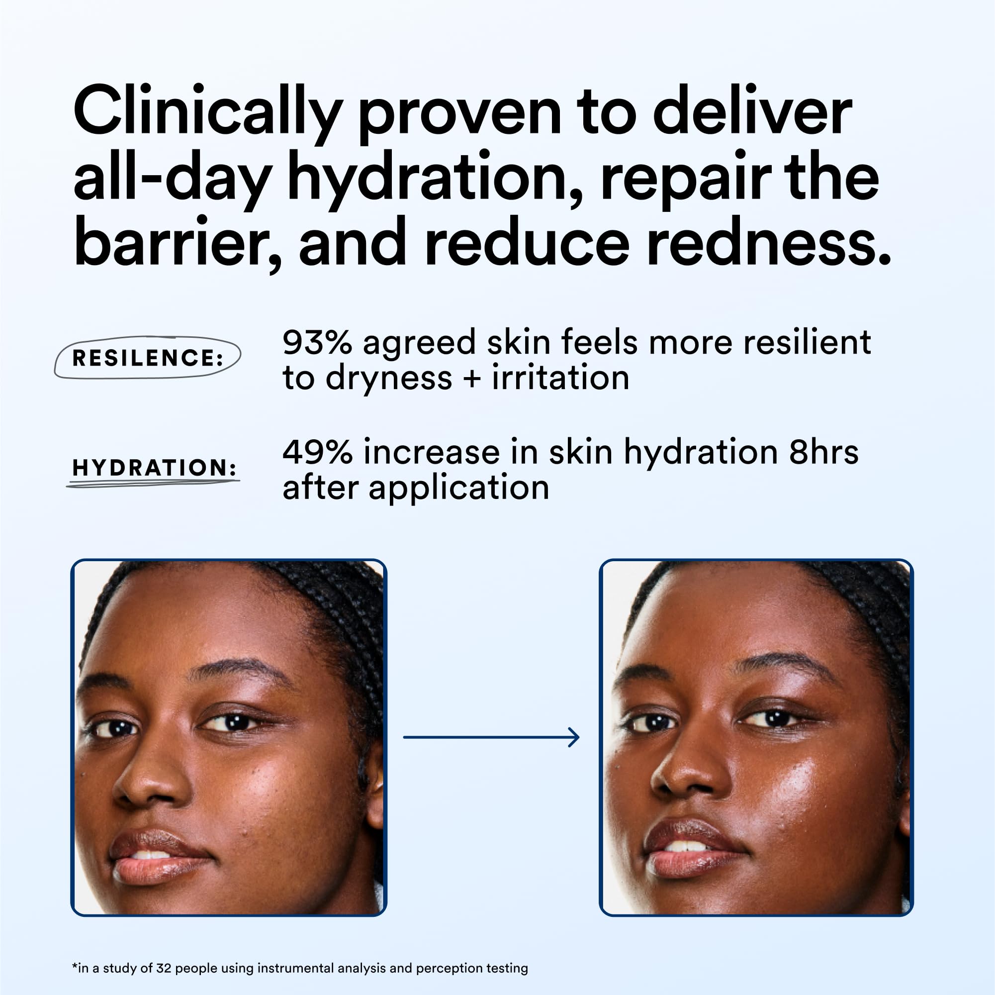 Experiment Molecular Mesh Barrier Moisturizer applied on skin for sensitive skin hydration