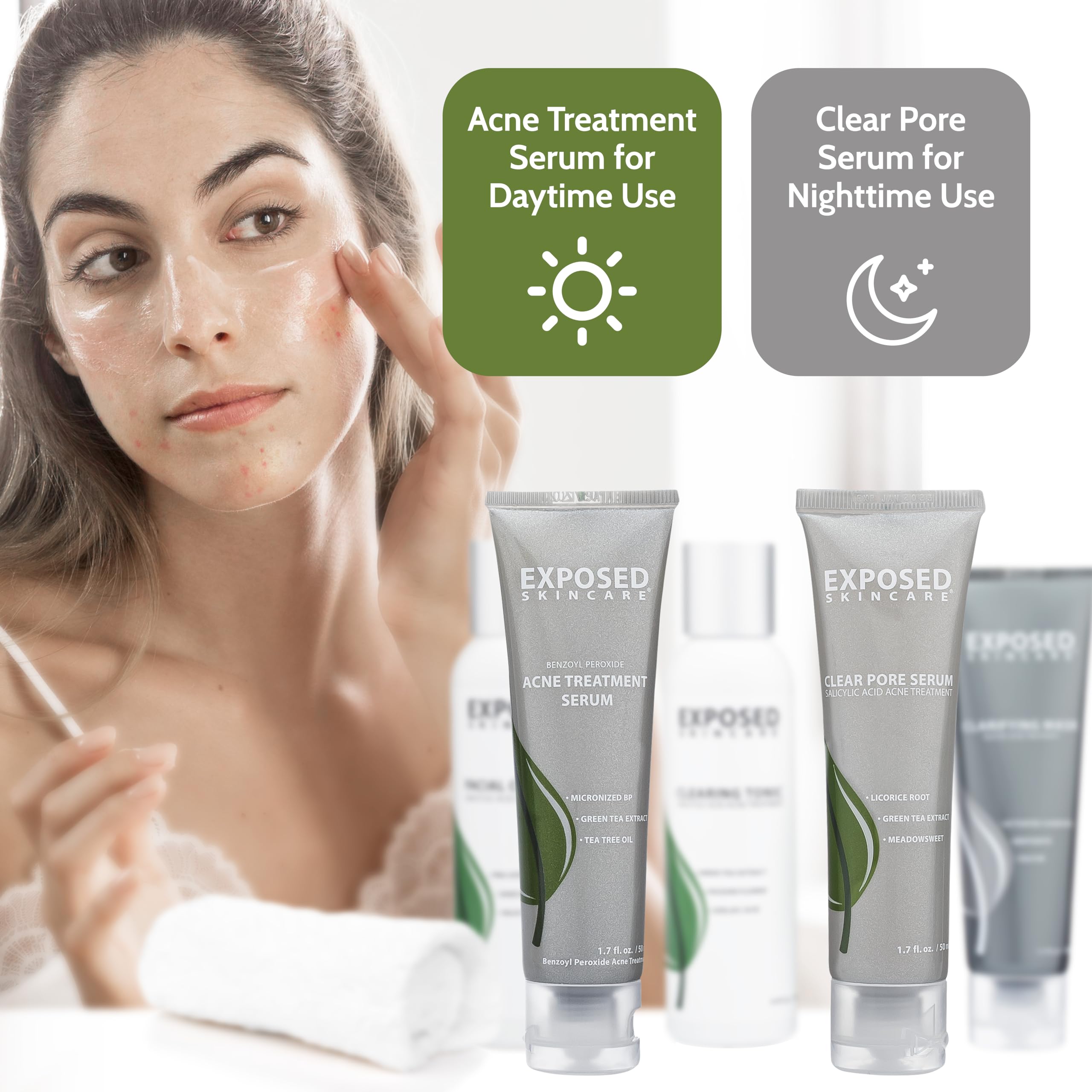 Exposed Skin Care acne kit packaging box ready for home use