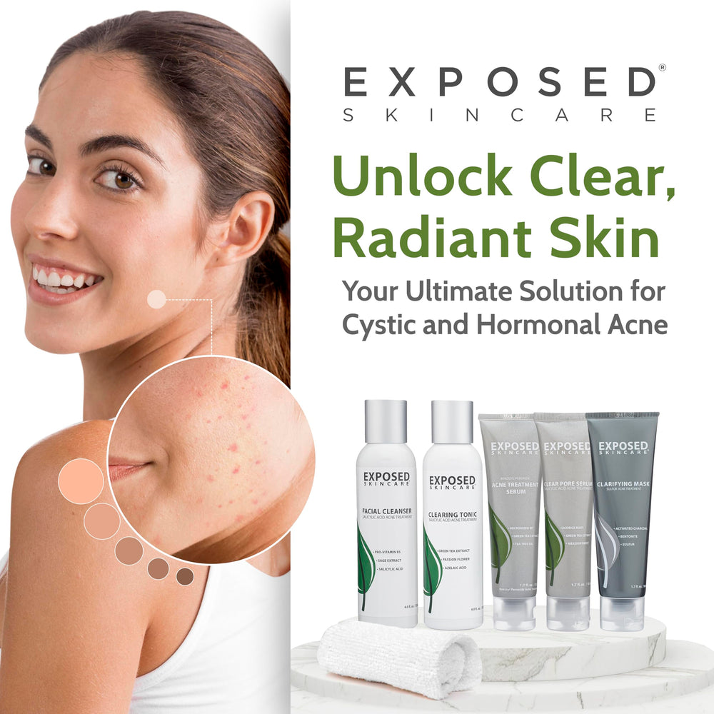Exposed Skin Care acne kit routine setup for a two-month supply