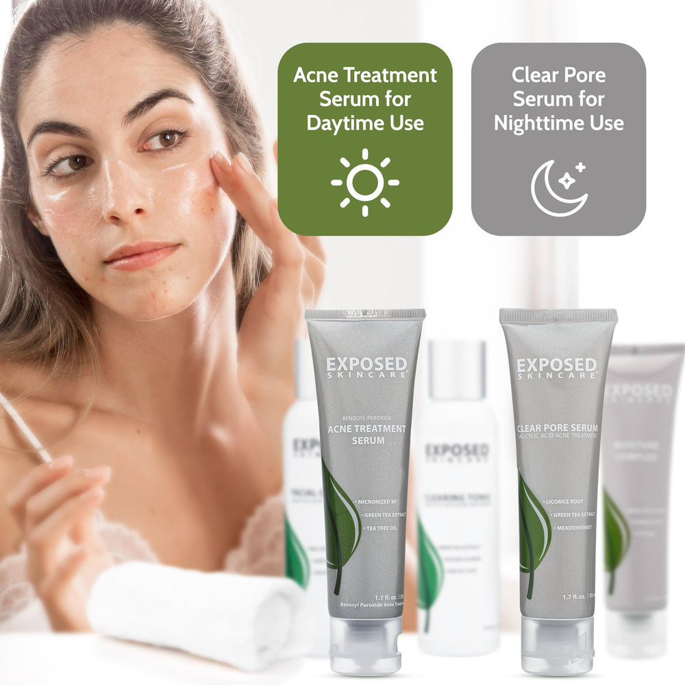 Exposed Skin Care bottle on shelf communicates premium, non-toxic care.