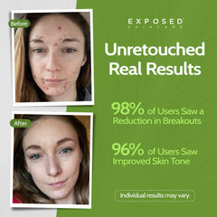 Exposed Skin Care Moisture Complex gel texture close-up highlights oil-free hydration
