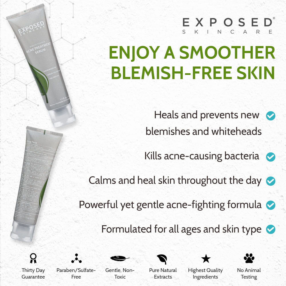 Exposed Skin Care tea tree oil and green tea blend in bottle.
