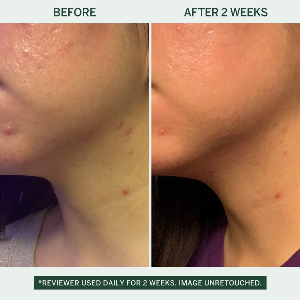 FACETORY Urban Calm Barrier Cream hyaluronic-acid-bottle highlights hydration without heaviness.